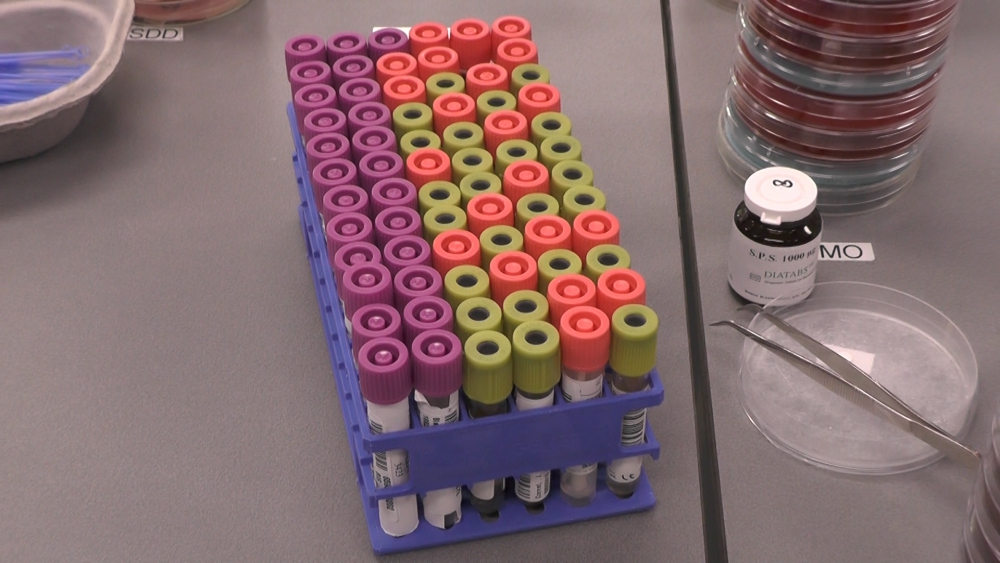 34 patiënten overleden, 545 nieuwe patiënten, in totaal 4749 positief geteste personen