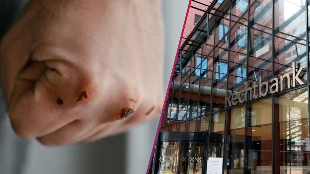Schiedammer bijt stuk van moeders neus af: ‘Daarna draai ik je oren eraf’